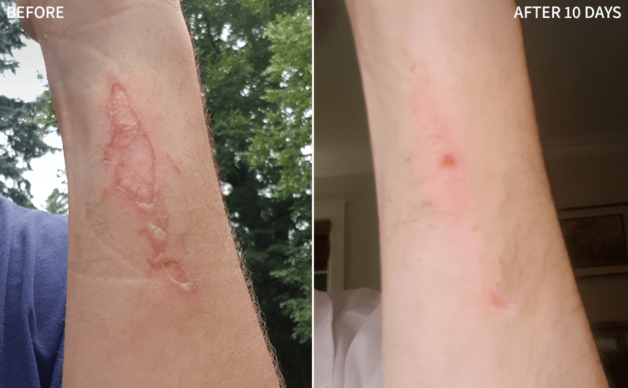 Before and after — Amanda C., 6 Weeks