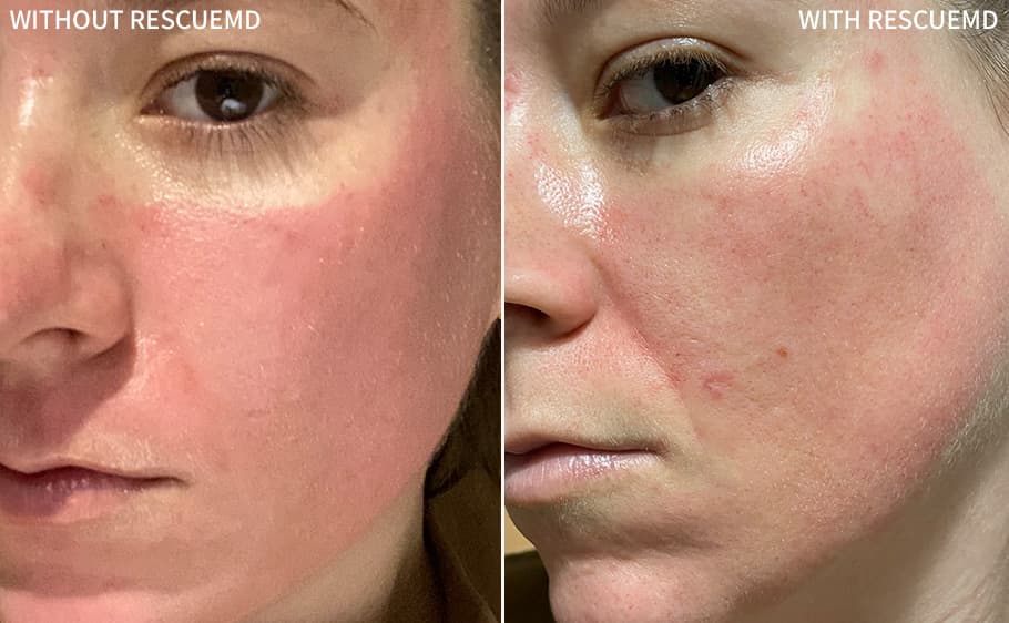 Before and after — Melissa R., 4 Weeks