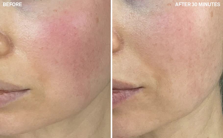 Before and after — Karen L., 12 Weeks